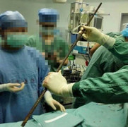 Cứu sống người đàn ông bị thanh sắt đâm xuyên từ háng lên đầu