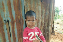 Bé trai người Gia Lai mắc bệnh não tụt xuống mũi được 'tái sinh' sự sống