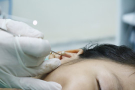 Hạt đồ chơi 'đi lạc' vào tai bé gái 8 tuổi ở Quảng Ninh