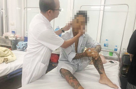 Nam thanh niên nhiễm viên gan B nghi do ‘nghiện’ xăm trổ