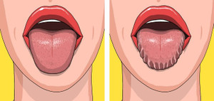 Những dấu hiệu bất thường trên cơ thể tố cáo sức khỏe bạn đang có vấn đề trầm trọng