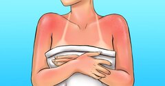 8 mẹo hay giúp bảo vệ làn da của bạn khỏi bị lão hóa nhanh
