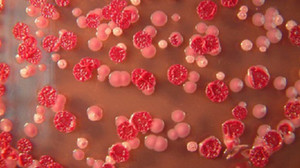 Hai anh em ruột thiệt mạng do nhiễm Whitmore: Sở Y tế Hà Nội nói gì?