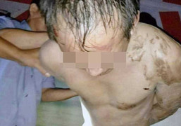 Phụ huynh vây đánh, lột trần thầy giáo giữa đám đông