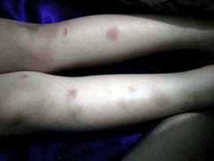 Bé 4 tuổi tố bị cô giáo trường mầm non quốc tế đánh