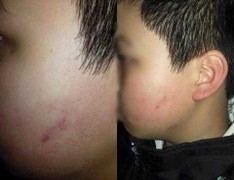 Học sinh bị 42 bạn tát không muốn đến lớp