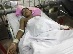 Côn đồ vác kiếm chém thanh niên bán mía gục tại chỗ