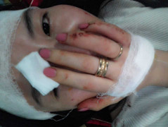 Thiếu nữ tố bị cô giáo cấp 2 bắt cóc, hành hung dã man trên taxi