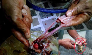 Chế biến thịt cóc ăn trưa, 2 vợ chồng chết thương tâm