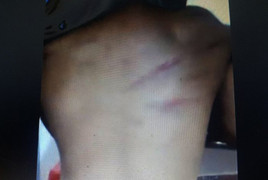 Đánh học sinh bầm lưng ở Hà Tĩnh: Học sinh chuyển trường, cô giáo bị kỷ luật cảnh cáo