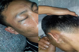 Nam thanh niên tố bị công an xã ở Hà Tĩnh tát đến thủng màng nhĩ