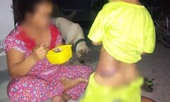Bé trai khuyết tật 7 tuổi bị cô giáo đánh bầm tím khắp người