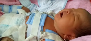 Thông tin mới nhất vụ trẻ sơ sinh bị gãy đùi do bác sỹ mổ đẻ