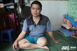 Nam thanh niên bị cưa cụt chân tố bệnh viện tắc trách: Sở Y tế Đồng Nai kết luận thế nào?