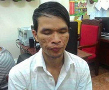 Lời khai của tên bất lương đánh trẻ em dã man bằng roi điện