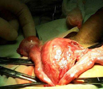 Phát hiện chấn động tại Việt Nam: Người đàn ông có cả 'tử cung lẫn buồng trứng'