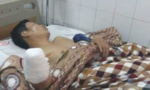 Đốt pháo đón Giao thừa, kẻ què, người chột