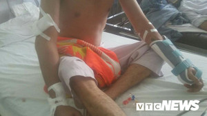 Sau tiệc sinh nhật, nam thanh niên bị chém đứt gân 2 cánh tay