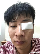 Nhắc nhở tài xế đậu xe trên đường cấm, nam thanh niên bị đánh bầm dập