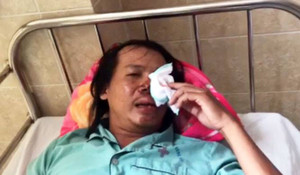 Hiệp sĩ Đồng Nai bị nhóm trộm chó dùng súng điện bắn trọng thương