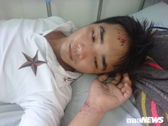 Nam công nhân ở TP.HCM tố bị công an xã còng tay, đánh đập dã man vì nghi lấy trộm giày