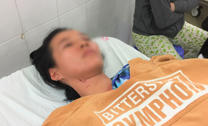 Chồng đánh đập, dìm vợ xuống hồ nước ở Tây Ninh: Lời kể hãi hùng của nạn nhân