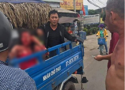 Bắt gã đàn ông xông vào quán cà phê rạch mặt người tình cũ