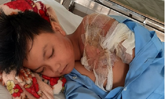 Xác minh tin bé trai bị cha đổ nước sôi lên người, gây bỏng nặng