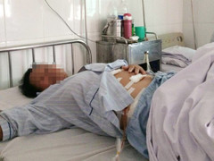 Kinh hoàng hàng trăm viên sỏi lấp đầy túi mật của một nữ bệnh nhân xứ Nghệ