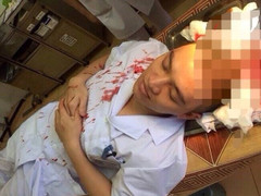 Côn đồ lao vào bệnh viện hành hung bác sĩ: Đòi hỏi y đức, vậy những kẻ côn đồ thì đạo đức gì?