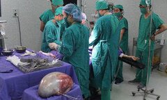 Phát hiện khối u to gần 7kg do đau bụng chủ quan không đi khám