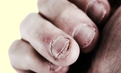 7 điều kinh khủng sẽ xảy ra nếu bạn cắn móng tay