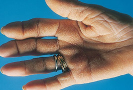 10 điều làn da 'mách' về sức khỏe của bạn