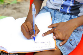 Sợ thần linh phạt, cả dòng họ bị dính liền ngón tay nhưng không dám phẫu thuật