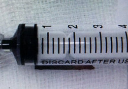 Nhiễm trùng nặng do ngoáy tai bằng chân nhang rồi... 'bỏ quên' hơn 1 năm