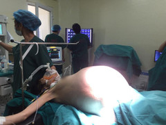 Bệnh nhân nữ có khối u buồng trứng 'khủng' 16kg to như mang thai sinh đôi