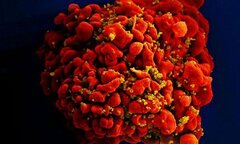 Bé gái 9 tuổi là người thứ 3 trên thế giới được chữa khỏi HIV
