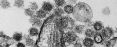 Mỹ bỏ lệnh cấm gây quỹ cho nghiên cứu các loại virus 'chết người'