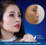 Nổi bật những ca mũi khó được giải cứu 2018