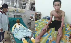Sự sống hồi sinh với tấm thẻ màu xanh