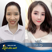 10 ca phẫu thuật thẩm mỹ thành công khiến ai cũng ngỡ ngàng