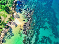 Làn sóng mới từ du lịch chăm sóc sức khỏe