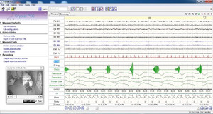 Giải mã các rối loạn giấc ngủ bằng phương pháp đa ký