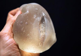 Túi ngực có thể bị vỡ trên máy bay trong trường hợp nào?