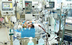 Hít phân su trong bụng mẹ, bé một ngày tuổi viêm phổi nặng