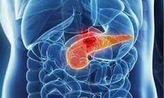 Người đàn ông 37 tuổi suýt thiệt mạng vì viêm tụy, bác sĩ cảnh báo 6 điều cấm kỵ