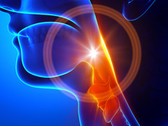 Những dấu hiệu dễ nhầm lẫn của ung thư vòm họng