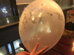 Hút 10 quả bóng cười mỗi tuần, nam thanh niên nhập viện khẩn cấp