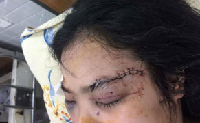 Cô gái bị 20 thanh niên truy sát, cắt tai: Giao Bộ Công an vào cuộc