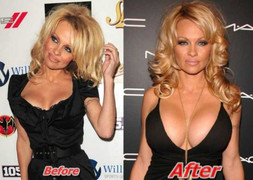 10 người đẹp nâng cấp để có vòng 1 'khủng' tốn tiền nhất Hollywood